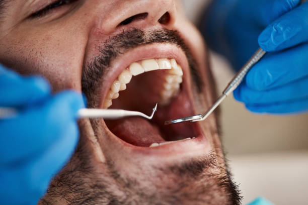 Best Broken or Cracked Tooth Emergency Dentist in Hurricane, UT